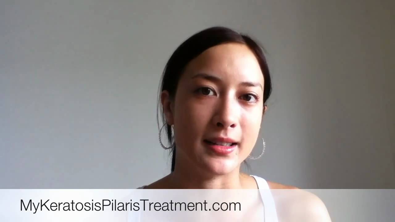 Keratosis Pilaris & Vitamin A Deficiency For Upper Arms YouTube