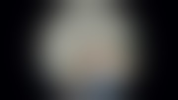 Trigeminal Neuralgia - Endoscopic Microvascular Decompression