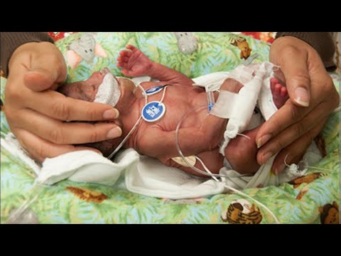 ATTENTION DORE IBI BINTU 8 BYATUMA UBYARA IGIHE KITAGEZE SIGNS AND SYMPTOMS OF PREMATURE RABOUR