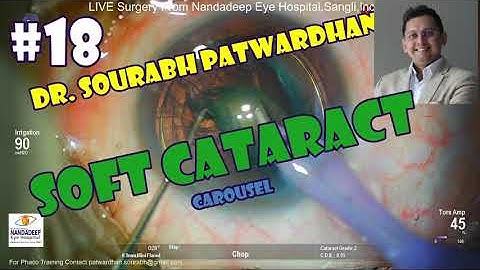 Commented 18 Soft cataract carousel Dr Sourabh Patwardhan