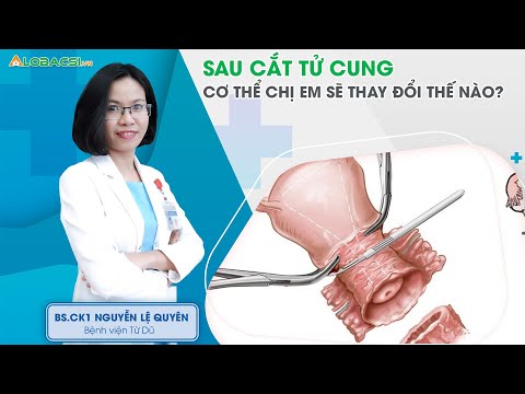 Video: Phần tử con gái là gì?