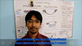Wound Healing Part 2 (HD): Cutaneous Wound Healing, Factors & Complications Of Healing (HD)