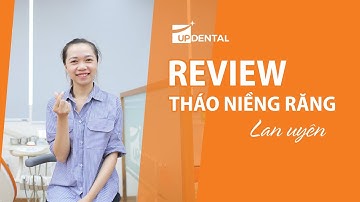[Review niềng răng]: #157 Kết quả niềng răng của Lan Uyên