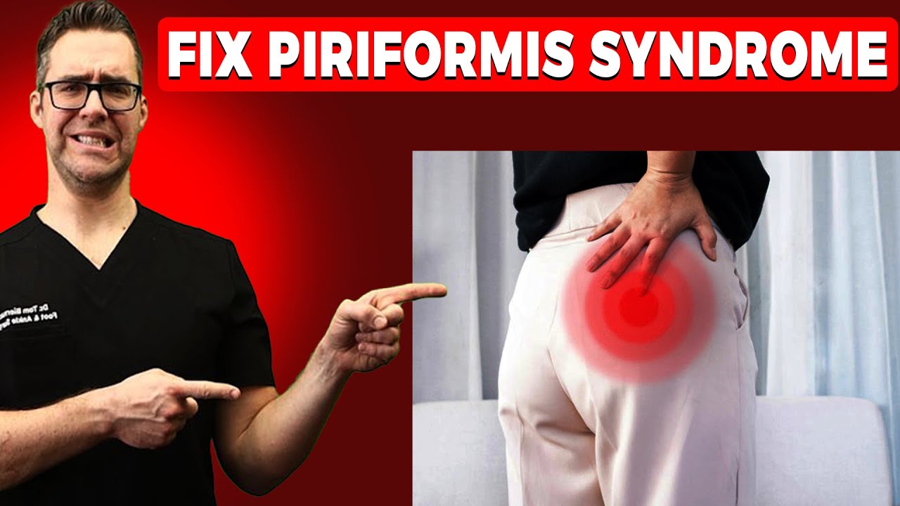Piriformis Syndrome Won't Go Away? [Stretches I Exercises I Treatment]