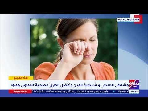 هذا الصباح نصائح مهمة لمرضى السكر من د إيهاب سعد عثمان أستاذ طب العيون للحفاظ على العين