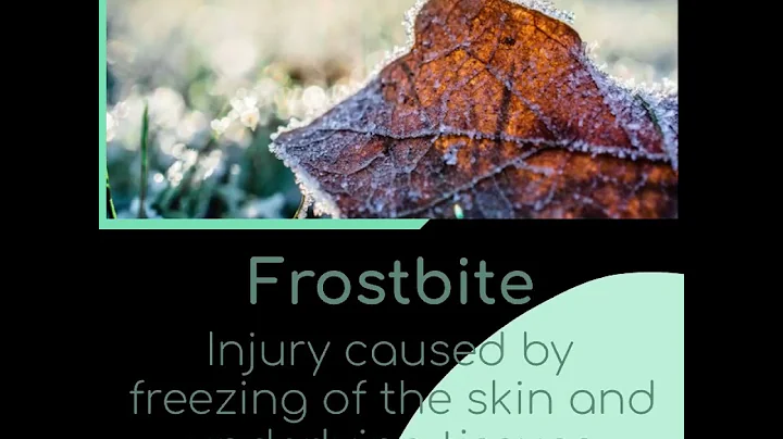 Surviving the Chill: Mastering Cold-Related Emergencies | First Aid Rocks #firstaid  #hypothermia