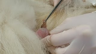 FUR removed from what was thought to be a SEBACEOUS CYST!! - Teratoma or dermoid cyst