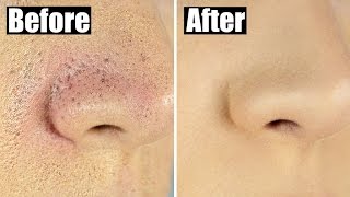 How to Reduce Bumpy, Textured Foundation for Smooth, Flawless Skin