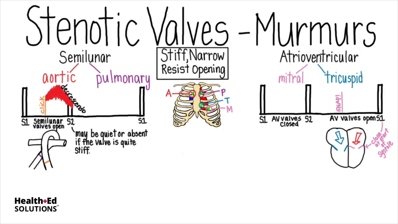 Heart Murmurs And Valve Disease Heart Murmur Series Youtube