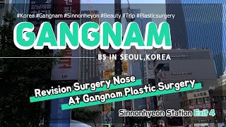 Revision Surgery Nose At Gangnam Plastic Surgery