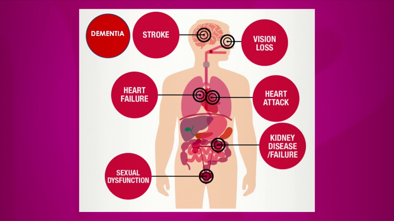 Causes Of High Blood Pressure YouTube