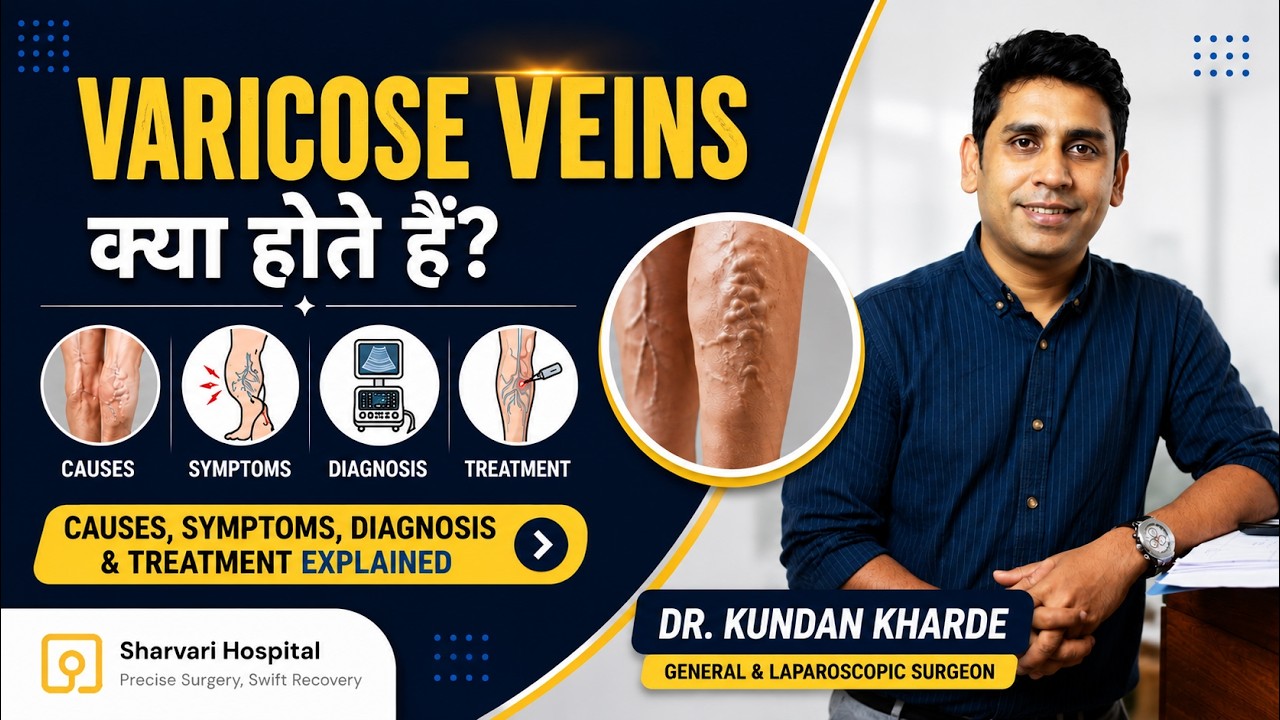 वीडियो: Varicose Veins क्या होती हैं? — Dr. Kundan Kharde, Sharvari Hospital Pune