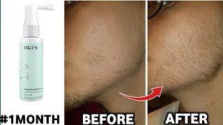 mars by ghc 1 month beard oil review | mars by ghc beard oil review |mars by ghc minoxidil review|