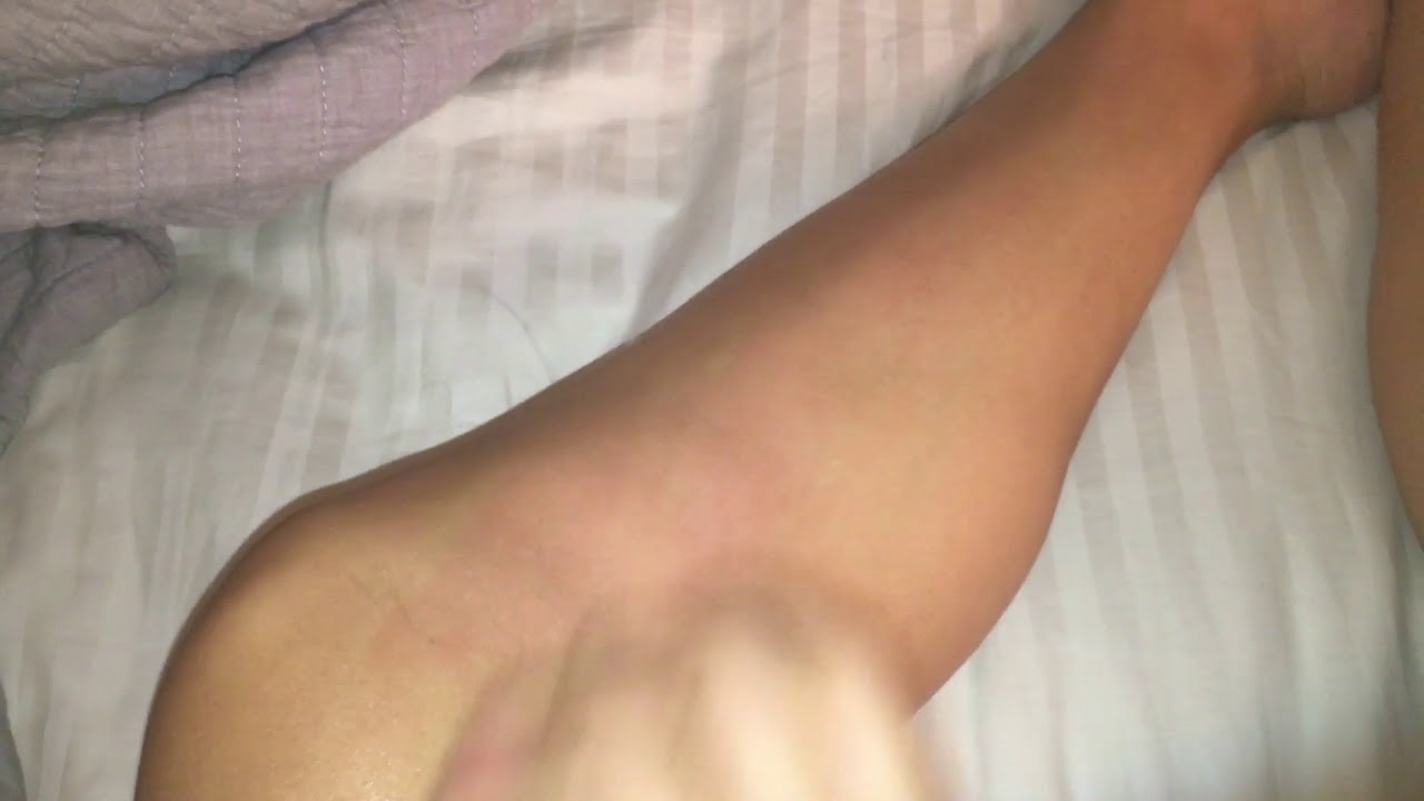 ASMR Aggressive Skin Scratching :D