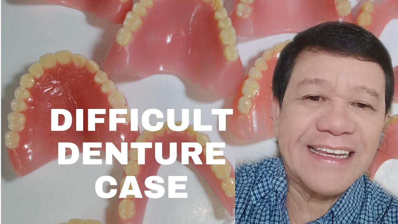 HOW DIFFICULT DENTURE CASE IS DONE/ TIPS ON HOW TO BE SUCCESSFUL DENTAL