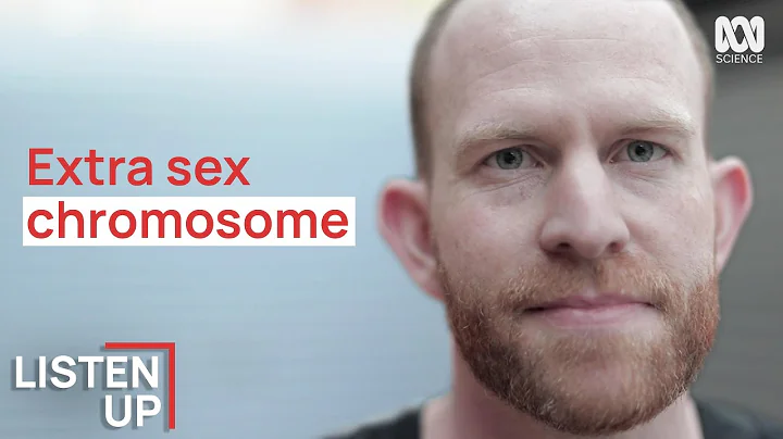 I Was Born With An Extra Chromosome | Listen Up | ABC Science