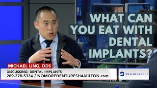 What Can You Eat with Dental Implants? | All On 4, All On X | Hamilton, ON | Dr. Michael Ling