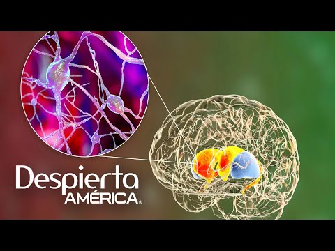 ¿Por qué las neuronas motoras fallan? Síntomas y enfermedades de movilidad | Dr. Juan