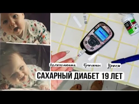 Видео: 19 ЛЕТ САХАРНОГО ДИАБЕТА Моя история