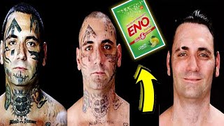 Tattoo removal at Home | How to Remove Tattoo at Home | Tattoo Kaise Hataye