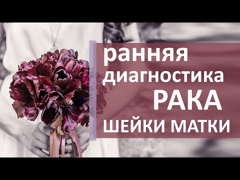 Лечение рака шейки матки. 🌼 Как выявить и лечить рак шейки матки. Моситалмед.