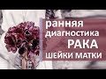 Лечение рака шейки матки. 🌼 Как выявить и лечить рак шейки матки. Моситалмед.