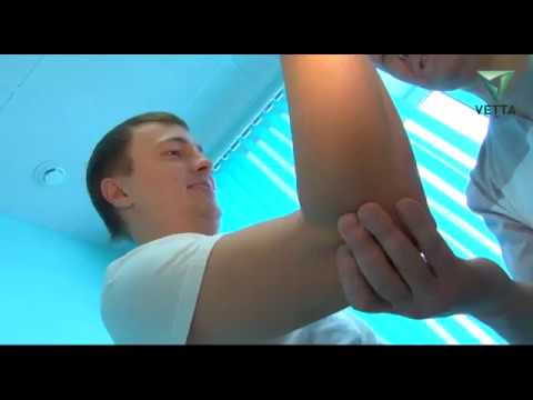 Поражение суставов. Артрит и артроз