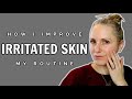 HOW I IMPROVE IRRITATED SKIN FAST! | MY SKINCARE ROUTINE, INGREDIENTS &amp; PRODUCTS