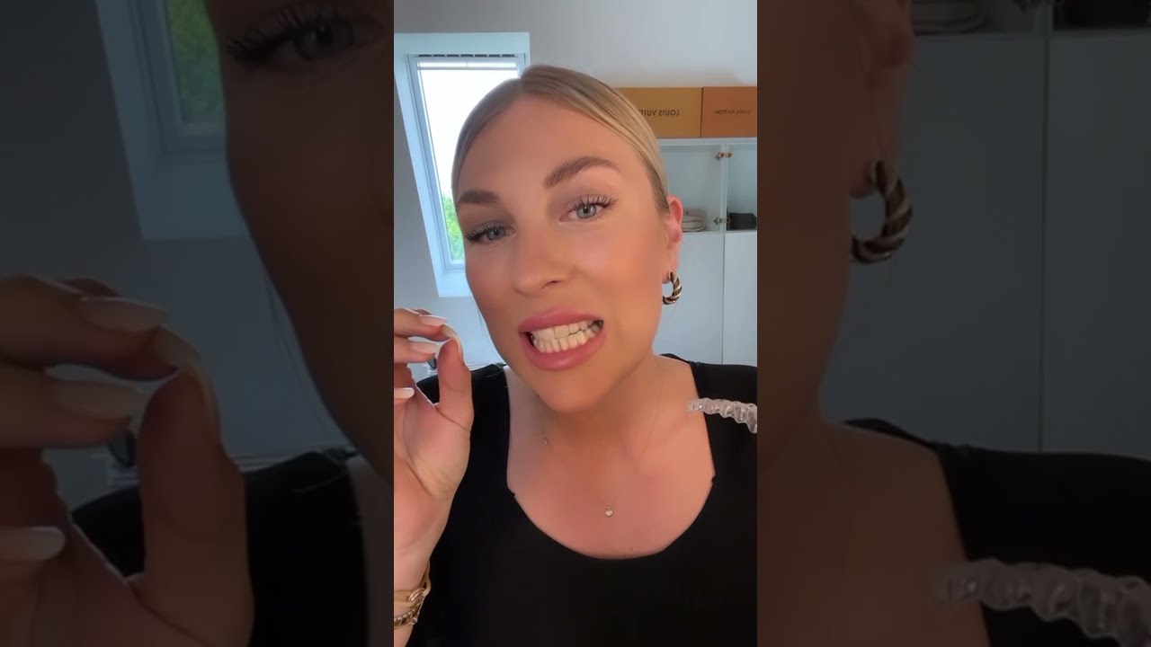 TWF You Open Up A Fresh Set Of Invisalign Aligners Karinagee 