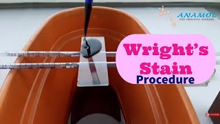 Wright's Stain Test | Wright's Staining