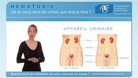 Comment éviter une infection du sang