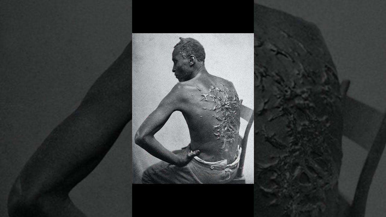 Destroyed Giant & Scarred Slave: Untold Stories of Human Cruelty & Resilience 
