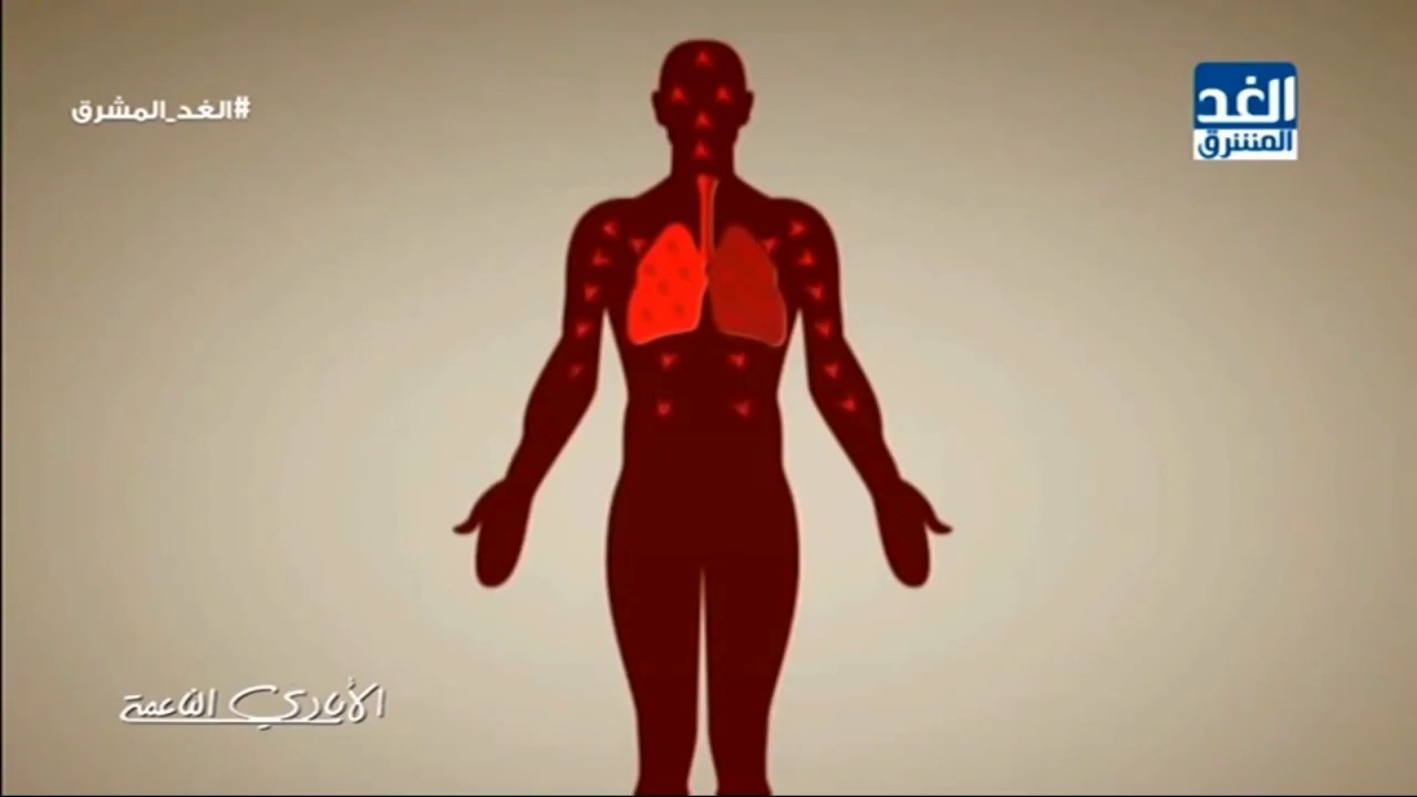 الأيادي الناعمة: فيديو توضيحي حول مرض 