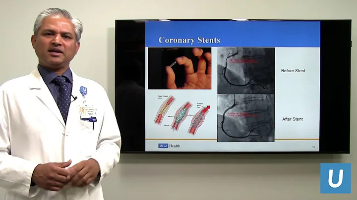 Coronary Angiography and Stent Interventions | Ravi Dave, MD | UCLAMDChat - DayDayNews