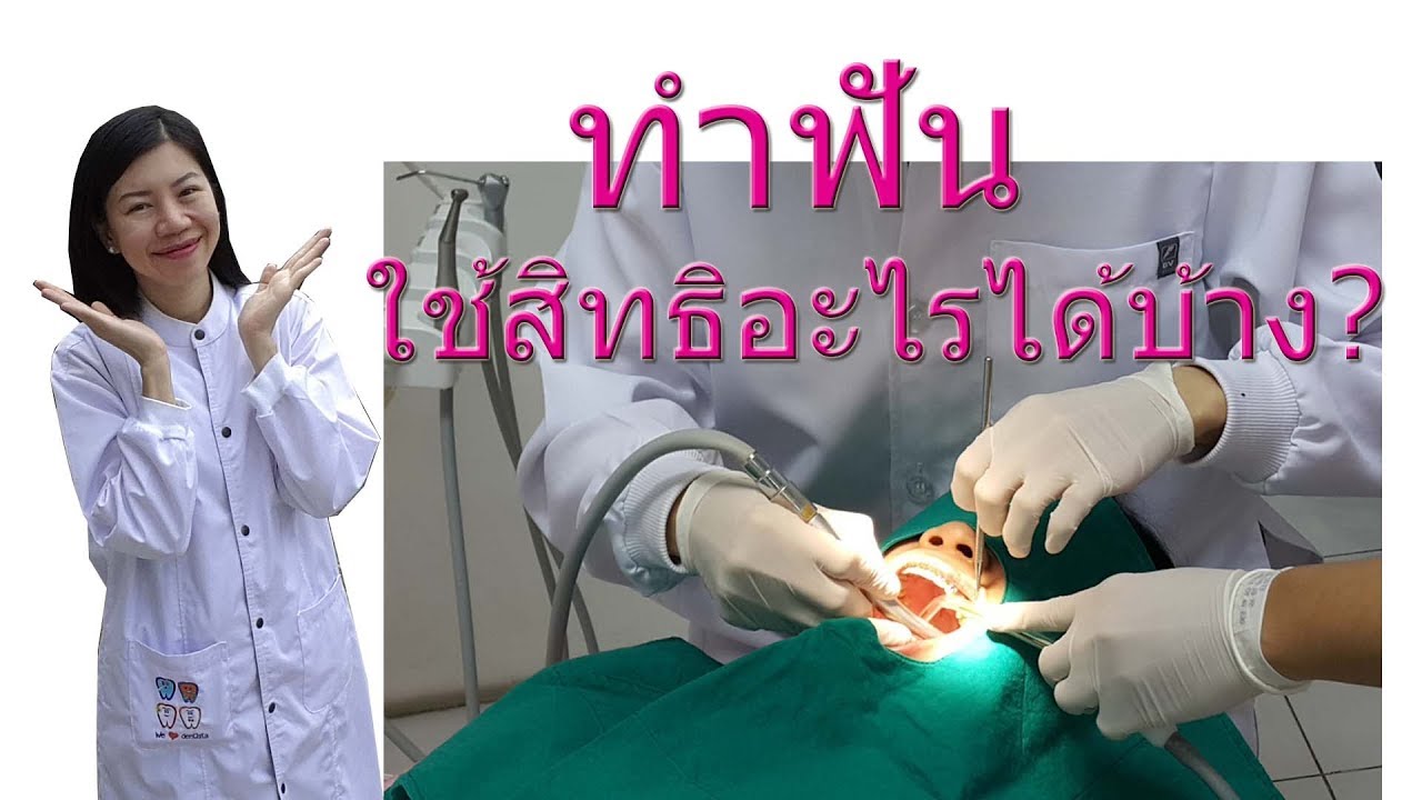 ทำฟันใช้สิทธิอะไรได้บ้าง