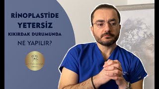 Primer Ya Da Revizyon Burun Ameliyatında Yetersiz Kıkırdak Varsa Ne yapılır?