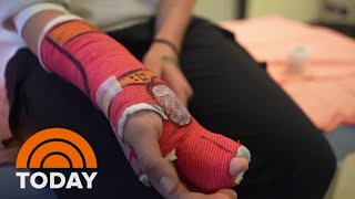This Medical Worker Puts Smiles On Young Patients Faces With Cast Art