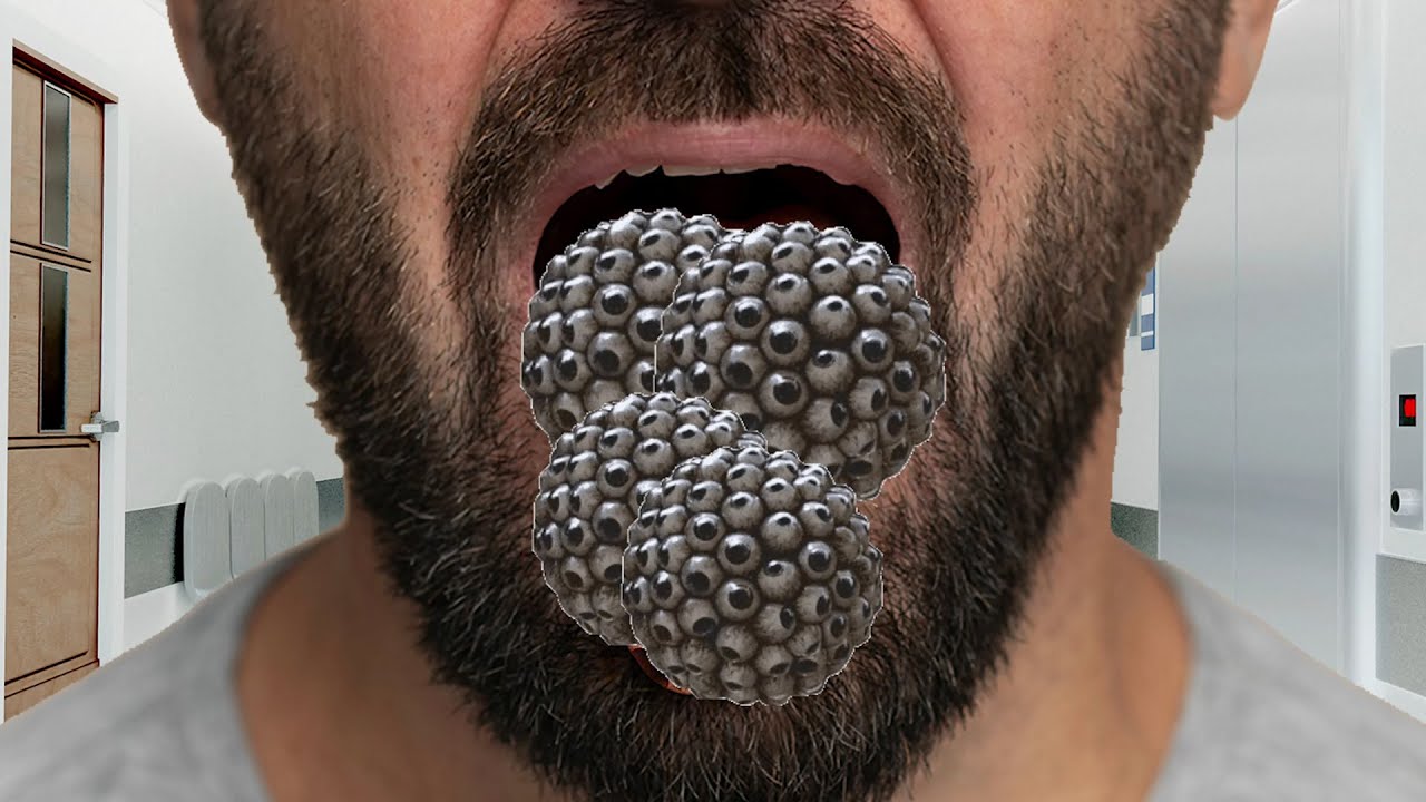 ASMR Maggot Infected Mouth Treatment & Dog Ticks Removal ASMR