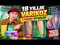 18 YILLIK VARIKOZ 5 KUNDA YO‘QOLDI 😱 | SHISHGAN OYOQLAR SOG‘AYDI!