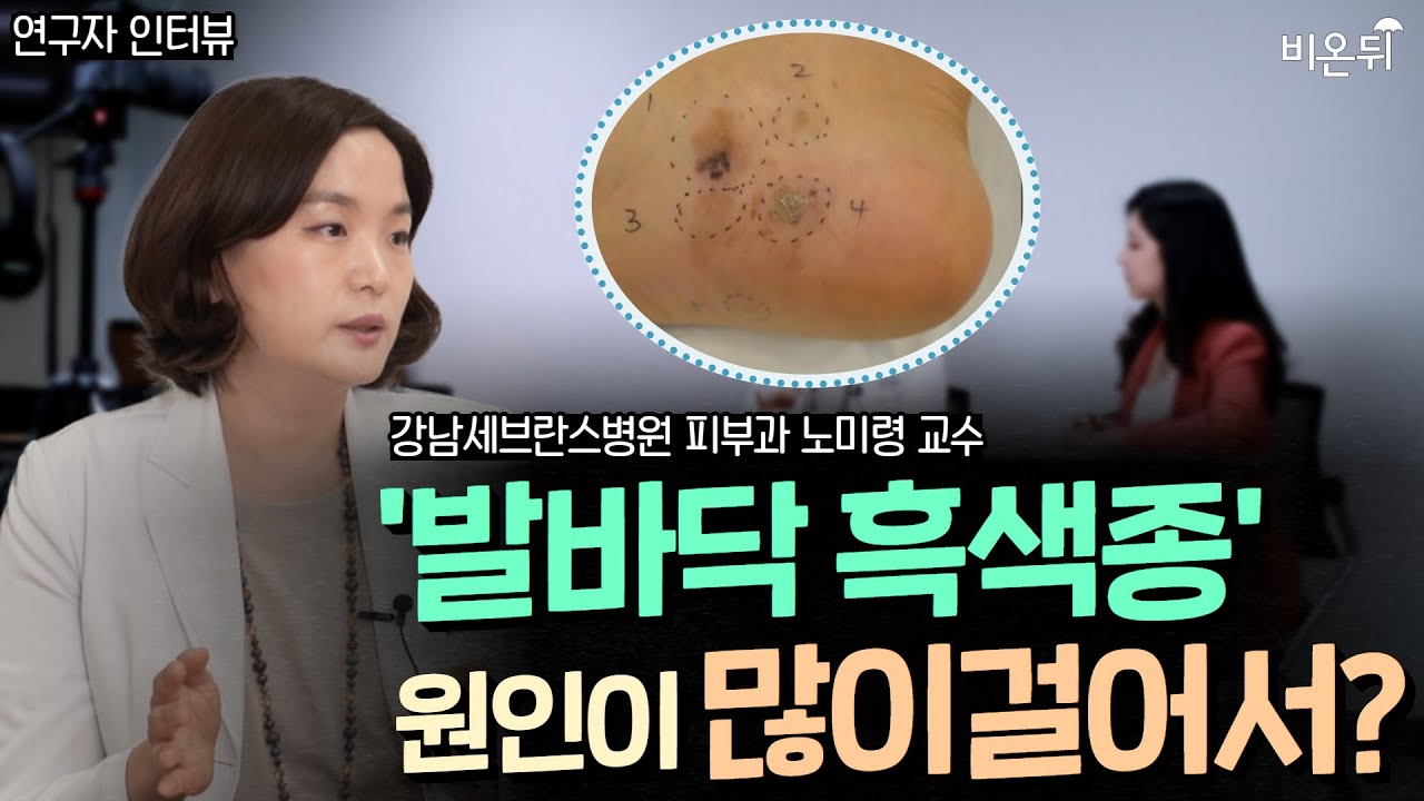 한국인에게 유독 많은 악성 흑색종의 원인은?ㅣ강남세브란스병원 피부과 노미령 교수