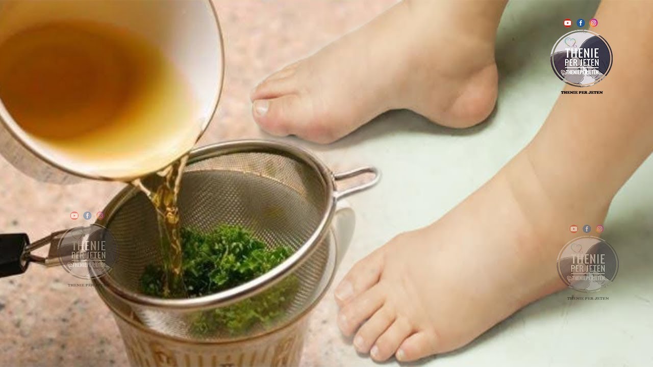 Nëse vuani nga fryerja e këmbëve, ja si ta lehtësoni këtë problem në kushte shtepie