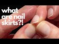 How to get rid of nail &quot;skirts&quot;.