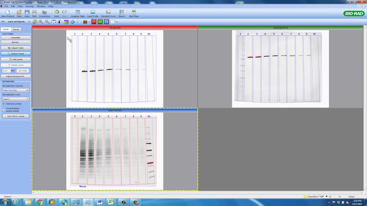 Total Protein Normalization Advanced Tutorial