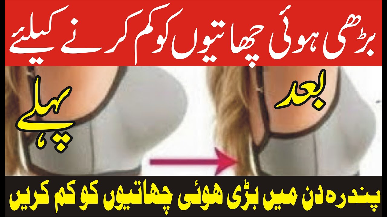 Breast ko Kaise kam karain / Chatiyon ko chota karne ka tarika / Barhe