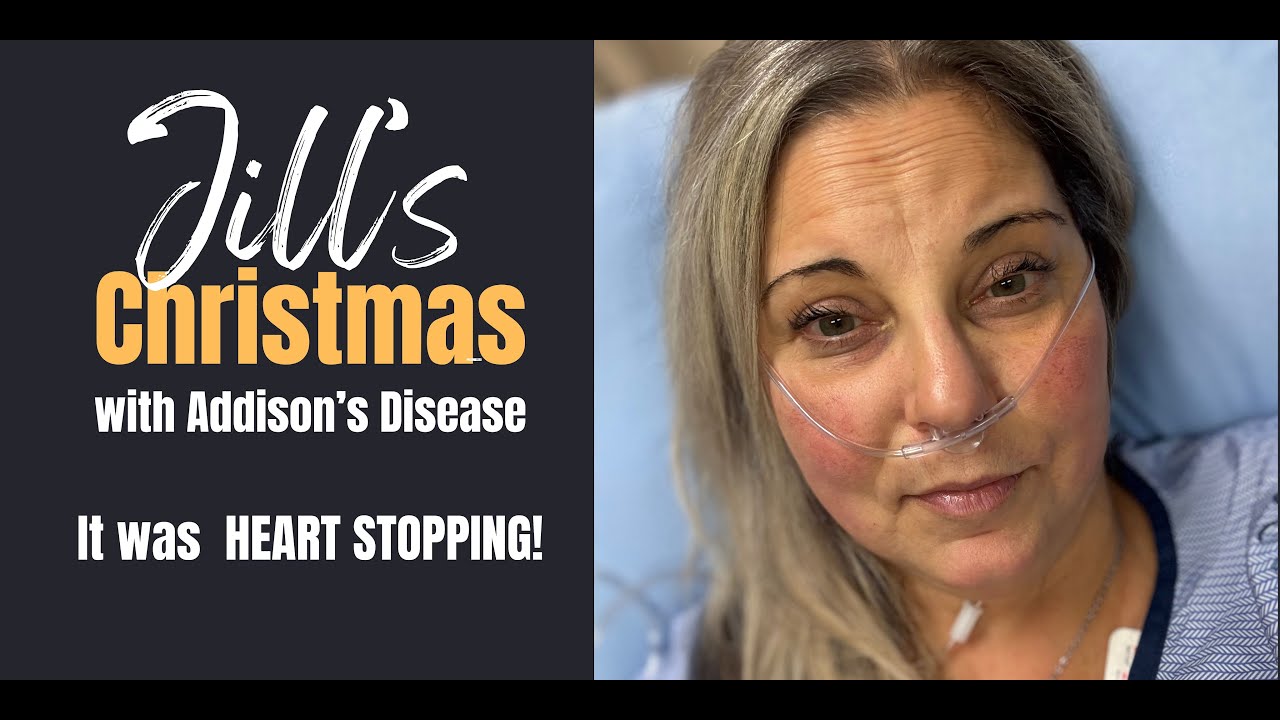 Addison's Disease - Heart Stopping Christmas - YouTube
