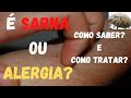 Tratamento da sarna   tratamentoda sarna coceira alergia