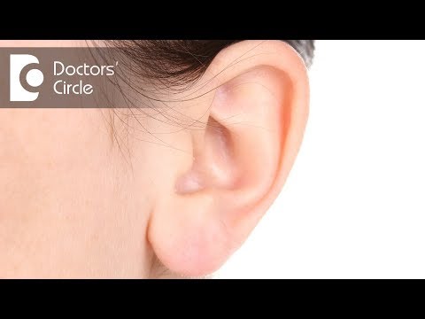 What causes benign Ear Lobe Cyst? - Dr. Harihara Murthy