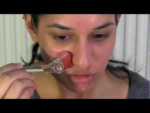 How to Use a Derma Roller | Dermaroller for Acne Scars | Micro Needling