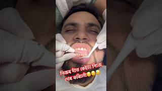 Nijor dat keita nijei hekh korilu😥😥.. #explore #ytshort #dental #dentalclinic #guwahati #assam