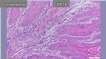 Olympus DP74 Microscope Camera - Frame Rate Comparison